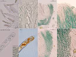 Attēlu rezultāti vaicājumam “Mniaecia jungermanniae”