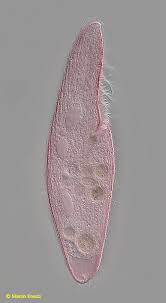 Attēlu rezultāti vaicājumam “Heterotrichia oerstedii (syn. Arcyria oerstedii) sessile”