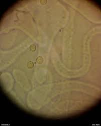 Attēlu rezultāti vaicājumam “Lycogala sphaeroconicum macro”