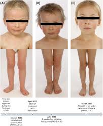 Attēlu rezultāti vaicājumam “Diderma subviridifuscum var. macrospora* young”