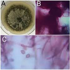Attēlu rezultāti vaicājumam “Diderma globosum spores”