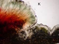 Attēlu rezultāti vaicājumam “Mycoblastus sanguinarius”