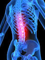 Severe Back Pain Relief