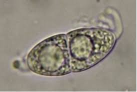 Attēlu rezultāti vaicājumam “Diderma simplex macro”
