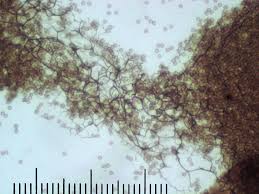 Attēlu rezultāti vaicājumam “Stemonitis pallida”