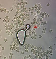 Attēlu rezultāti vaicājumam “Lycogala sphaeroconicum sessile”