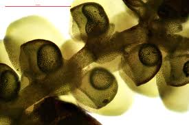 Attēlu rezultāti vaicājumam “Frullania fragilifolia macro”