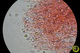 Attēlu rezultāti vaicājumam “Sidera lenis”