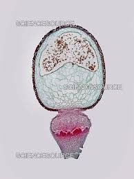 Attēlu rezultāti vaicājumam “Sphagnum sporophyte”