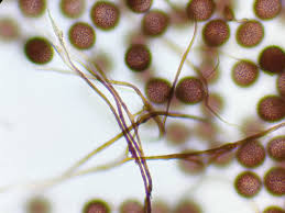 Attēlu rezultāti vaicājumam “Diderma subincarnatum spores”