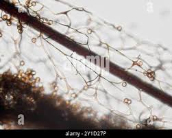 Attēlu rezultāti vaicājumam “Stemonitis lignicola macro”