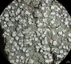 Attēlu rezultāti vaicājumam “Pertusaria amara”