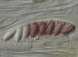 Attēlu rezultāti vaicājumam “Ascobolus furfuraceus”