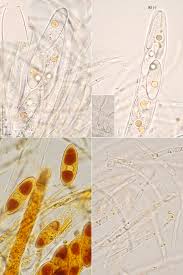 Attēlu rezultāti vaicājumam “Octosporella jungermanniarum”