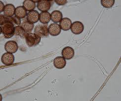 Attēlu rezultāti vaicājumam “Diderma globosum spores”