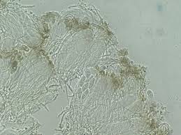 Attēlu rezultāti vaicājumam “Biatora sphaeroides”