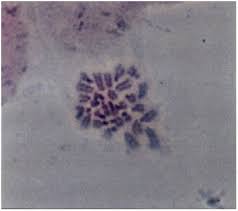 Attēlu rezultāti vaicājumam “Diprion pini male”