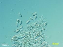 Attēlu rezultāti vaicājumam “Mycosphaerella millegrana”