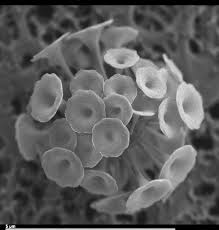 Attēlu rezultāti vaicājumam “Tubifera sp.”