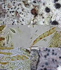 Attēlu rezultāti vaicājumam “Arthonia byssacea”