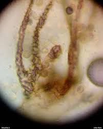 Attēlu rezultāti vaicājumam “Lycogala cf. fossiculatum”