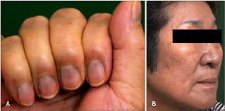 Image result for lunula nail