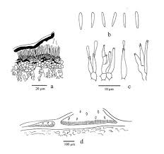 Attēlu rezultāti vaicājumam “Rhytisma acerinum”