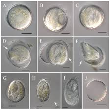 Attēlu rezultāti vaicājumam “Heterotrichia oerstedii (syn. Arcyria oerstedii) stalked”