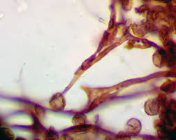 Attēlu rezultāti vaicājumam “Didymium annulisporum”