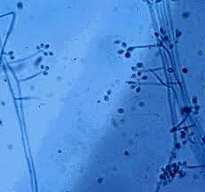 Attēlu rezultāti vaicājumam “Schistidium dupretii sporophyte”