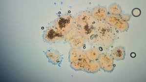 Attēlu rezultāti vaicājumam “Erythricium aurantiacum”