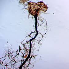 Attēlu rezultāti vaicājumam “Stemonitis foliicola stalked”