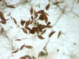 Attēlu rezultāti vaicājumam “Blepharostoma trichophyllum sporophyte”