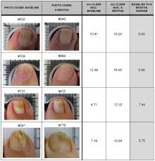 Image result for lunula nail