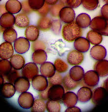 Attēlu rezultāti vaicājumam “Didymium tussilaginis spores”