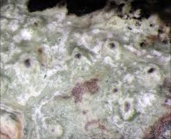 Attēlu rezultāti vaicājumam “Pertusaria leioplaca”