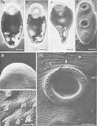 Attēlu rezultāti vaicājumam “Leucochloridium paradoxum”
