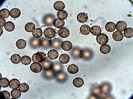 Attēlu rezultāti vaicājumam “Fuligo candida spores”