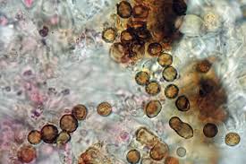 Attēlu rezultāti vaicājumam “Xanthoriicola physciae”