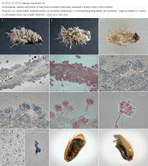 Attēlu rezultāti vaicājumam “Dianemataceae”