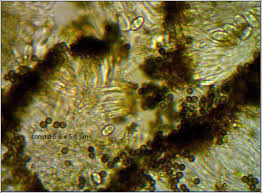 Attēlu rezultāti vaicājumam “Xanthoriicola physciae”