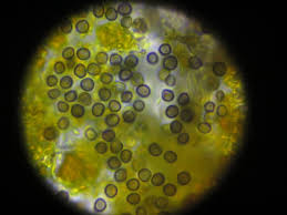 Attēlu rezultāti vaicājumam “Lichenoconium xanthoriae”