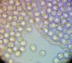 Attēlu rezultāti vaicājumam “Arcyria imperialis”