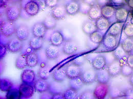 Attēlu rezultāti vaicājumam “Dianema depressum”