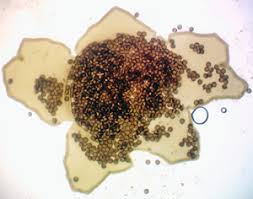 Attēlu rezultāti vaicājumam “Licea chelonoides spores”