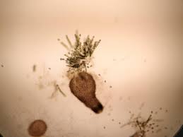 Attēlu rezultāti vaicājumam “Ascomycota”