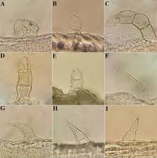 Attēlu rezultāti vaicājumam “Trichia contorta sessile”