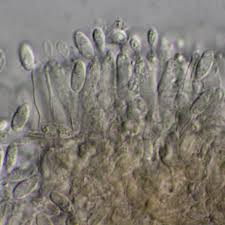 Attēlu rezultāti vaicājumam “Kretzschmaria deusta”