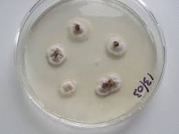 Attēlu rezultāti vaicājumam “Claviceps purpurea”