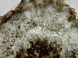 Attēlu rezultāti vaicājumam “Arthonia byssacea”